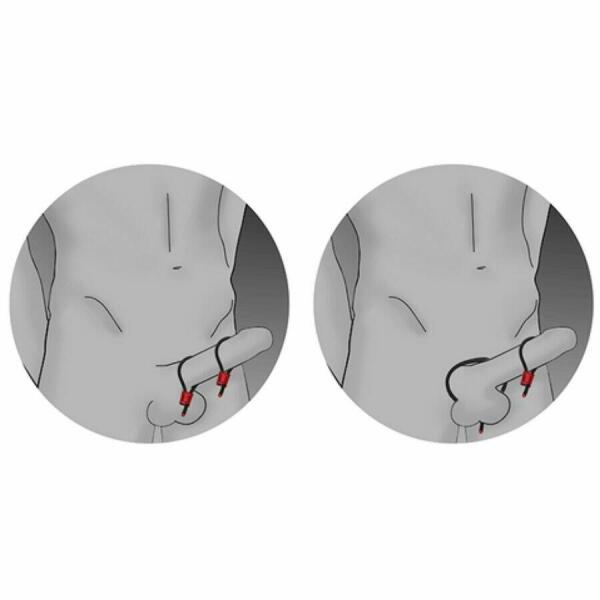 ELECTRASTIM - PRESTIGE ELECTRA LOOPS ADJUSTABLE COCK RINGS RED