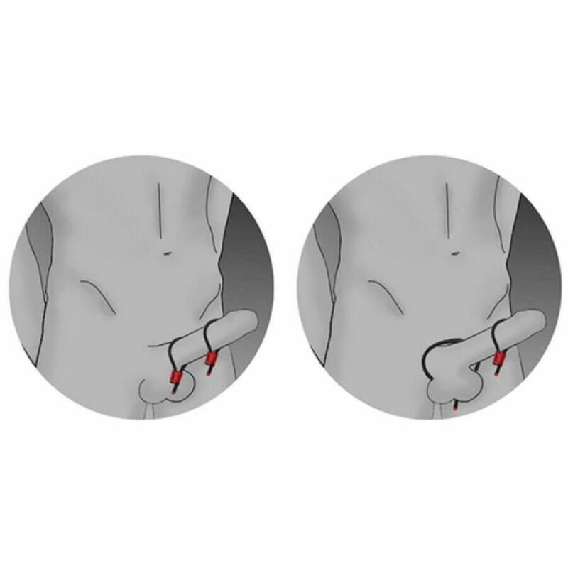 ELECTRASTIM - PRESTIGE ELECTRA LOOPS ADJUSTABLE COCK RINGS RED